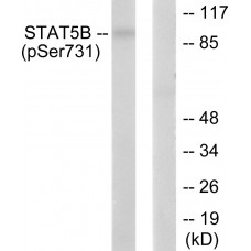 STAT5B (Phospho-Ser731) Antibody