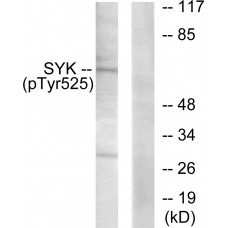 SYK (Phospho-Tyr525) Antibody