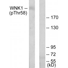 WNK1 (Phospho-Thr58) Antibody
