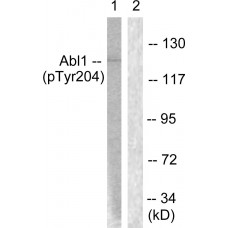 Abl (Phospho-Tyr204) Antibody