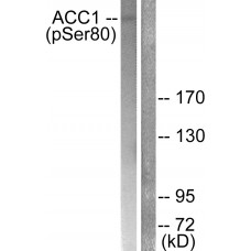 ACC1 (Phospho-Ser80) Antibody