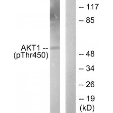 Akt1 (Phospho-Thr450) Antibody