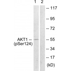 Akt (Phospho-Ser124) Antibody