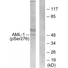 AML1 (Phospho-Ser276) Antibody