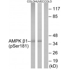 AMPK beta1 (Phospho-Ser181) Antibody