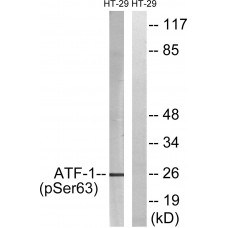 ATF1 (Phospho-Ser63) Antibody