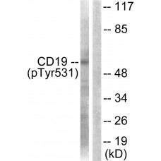 CD19 (Phospho-Tyr531) Antibody