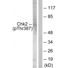 Chk2 (Phospho-Thr387) Antibody