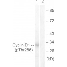 Cyclin D1 (Phospho-Thr286) Antibody