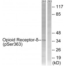 Opioid Receptor-delta (Phospho-Ser363) Antibody