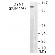 Dynamin-1 (Phospho-Ser774) Antibody