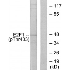 E2F1 (Phospho-Thr433) Antibody