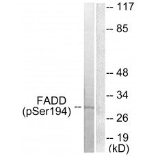 FADD (Phospho-Ser194) Antibody