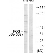 Fos (Phospho-Ser362) Antibody