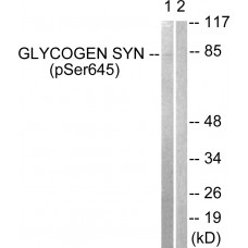 Glycogen Synthase (Phospho-Ser645) Antibody