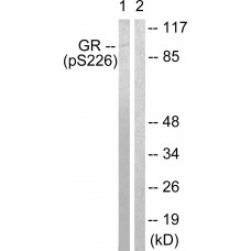 GR (Phospho-Ser226) Antibody