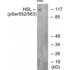 HSL (Phospho-Ser552) Antibody