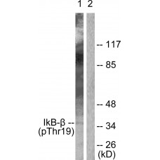 IkappaB-beta (Phospho-Thr19) Antibody
