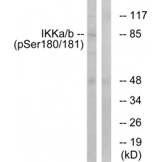 IKK-alpha/beta (Phospho-Ser180/181) Antibody