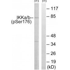 IKK-alpha (Phospho-Ser176) /IKK-beta (Phospho-Ser177) Antibody