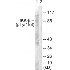 IKK-beta (Phospho-Tyr188) Antibody