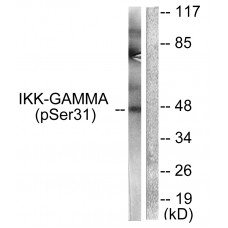 IKK-gamma (Phospho-Ser31) Antibody