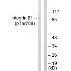 Integrin beta1 (Phospho-Thr788) Antibody