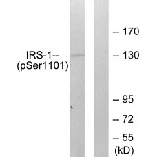 IRS-1 (Phospho-Ser1101) Antibody