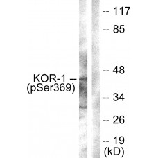 KOR-1 (Phospho-Ser369) Antibody