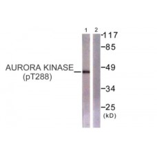 Aurora Kinase (Phospho-Thr288) Antibody
