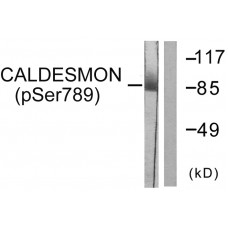 Caldesmon (Phospho-Ser789) Antibody