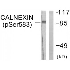 Calnexin (Phospho-Ser583) Antibody