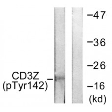 CD3 zeta (Phospho-Tyr142) Antibody