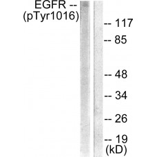 EGFR (Phospho-Tyr1016) Antibody