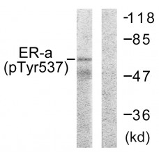 Estrogen Receptor-alpha (Phospho-Tyr537) Antibody