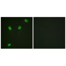 ERF (Phospho-Thr526) Antibody