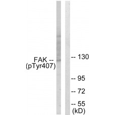 FAK (Phospho-Tyr407) Antibody