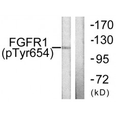FGFR1 (Phospho-Tyr654) Antibody