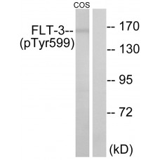 FLT3 (Phospho-Tyr599) Antibody