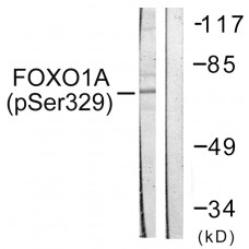 FOXO1A (Phospho-Ser329) Antibody