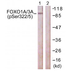 FOXO1A/3A (Phospho-Ser322+Ser325) Antibody
