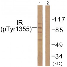 IR (Phospho-Tyr1355) Antibody