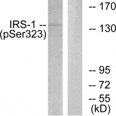 IRS-1 (Phospho-Ser323) Antibody