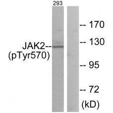 JAK2 (Phospho-Tyr570) Antibody