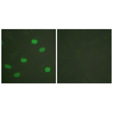 Lamin A/C (Phospho-Ser392) Antibody