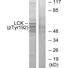Lck (Phospho-Tyr192) Antibody