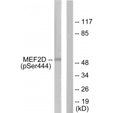 MEF2D (Phospho-Ser444) Antibody
