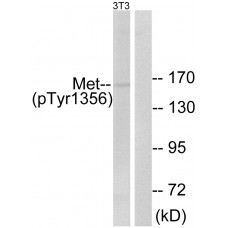 Met (Phospho-Tyr1356) Antibody