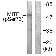 MITF (Phospho-Ser180/73) Antibody