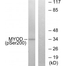 MYOD (Phospho-Ser200) Antibody